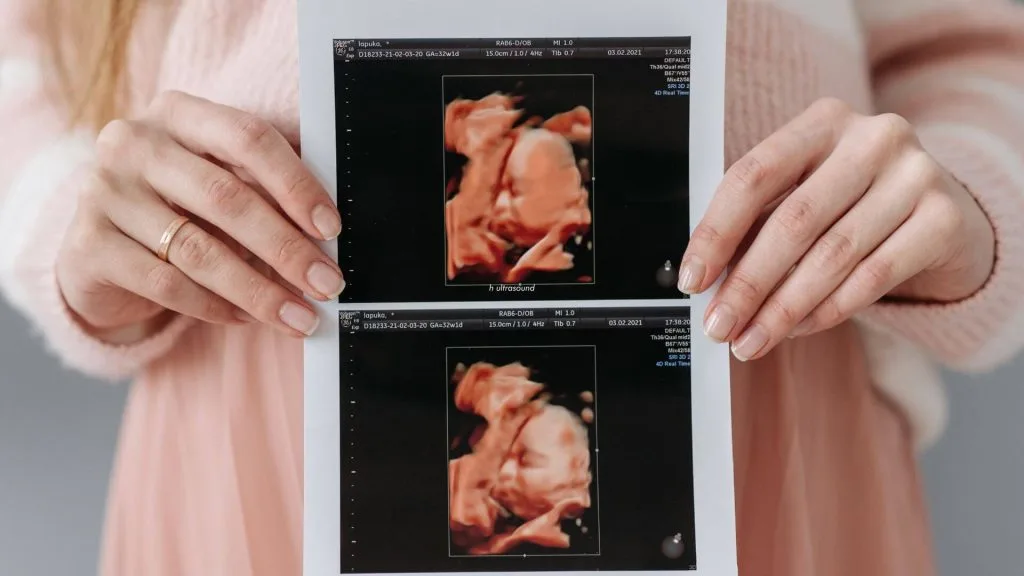 Ultrasound captures