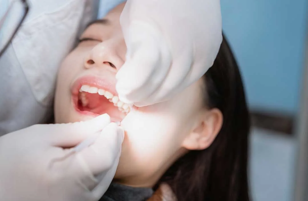 Preparing Your Child For A Wisdom Tooth Extraction