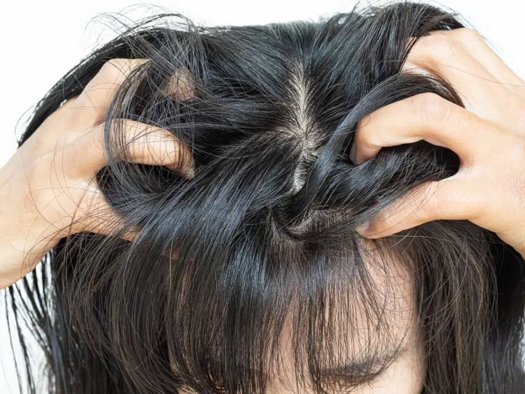 Flaky, irritated scalp