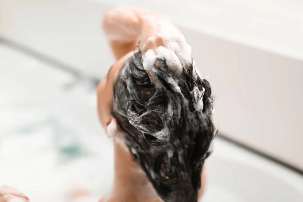 Treatment and Prevention of Scalp Infection-Induced Hair Loss