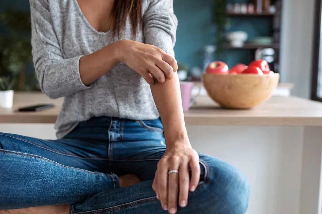 Woman trying to control eczema at home