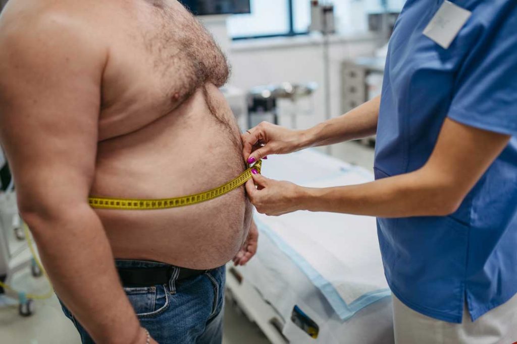 bariatric surgery
