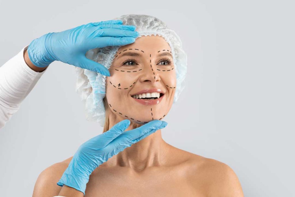 is a facelift right for me