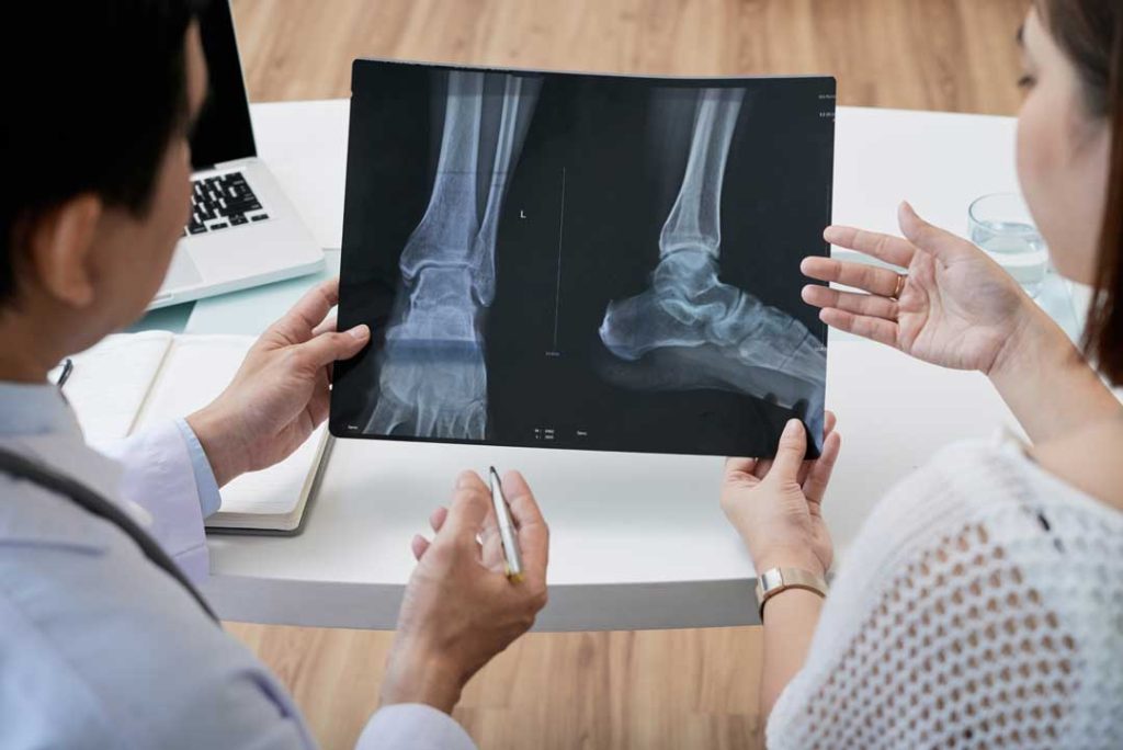 Doctor reviewing x-ray for signs of a bone fracture.