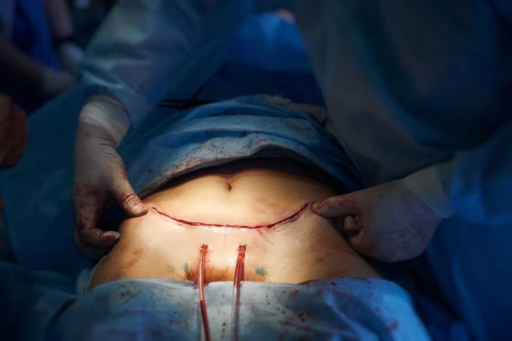 Wound Care and Signs to Watch