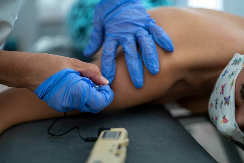 trigger point therapy